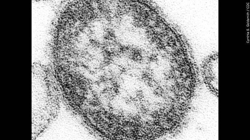 The measles outbreak may last for a year, according to experts.